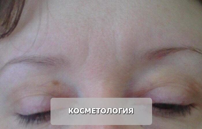 косметология_до