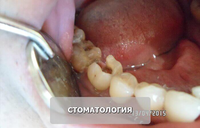 стоматология_до