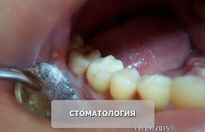 стоматология_после